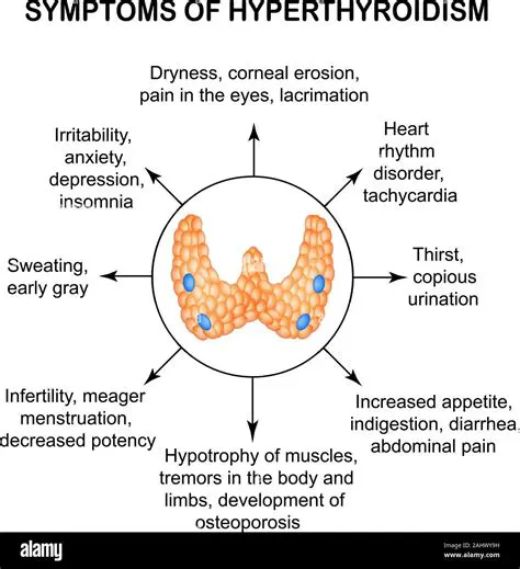 Background of Hyperthyroidism
