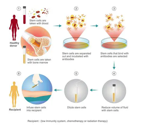 Bone marrow transplantation