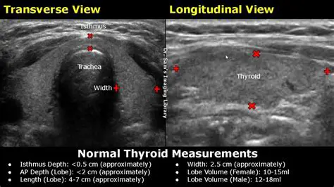 Key Features of Teroid Linear Gauge