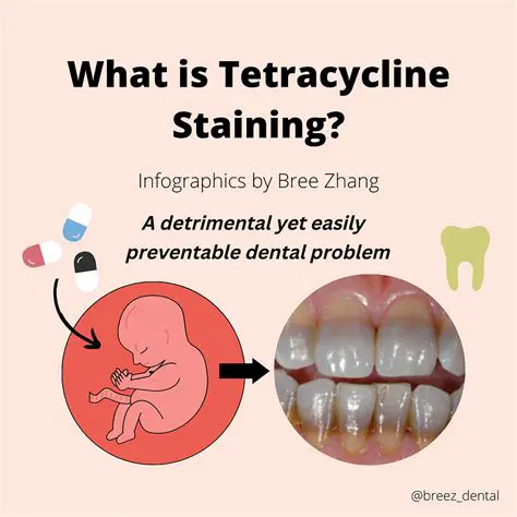 The Role of Tetracycline in Inhibiting Periodontal Pathogenic Bacteria