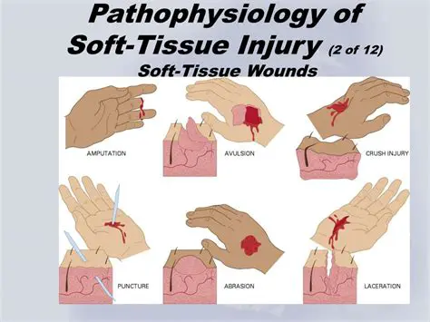 Types of Open Soft Tissue Injuries