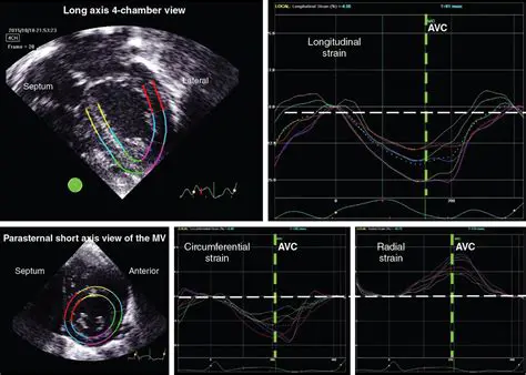 Understanding Doppler Placement